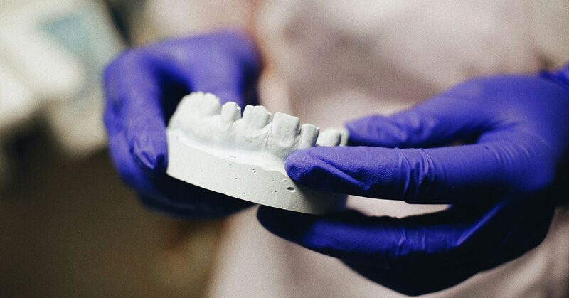 Manos con guantes sosteniendo un modelo de escayola de una arcada dental