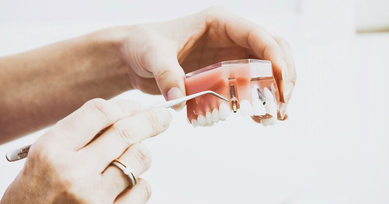 Manos señalando con un explorador un modelo dental con un implante y una corona