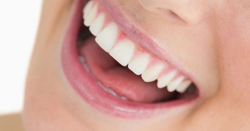 Primer plano de una sonrisa con dientes blancos y sanos