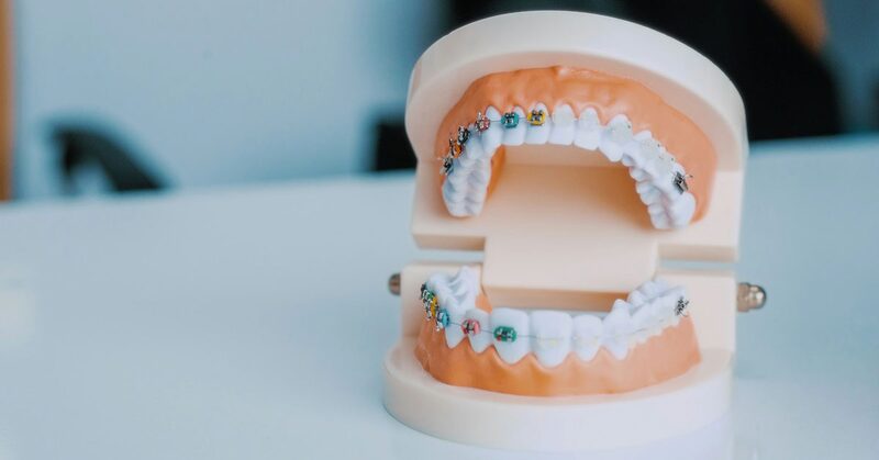 Maqueta dental de las dos arcadas sobre una mesa de consulta