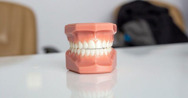 Maqueta dental de las dos arcadas sobre una mesa blanca