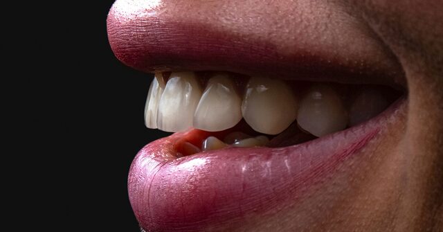 Primer plano de una boca entreabierta mostrando los dientes de perfil