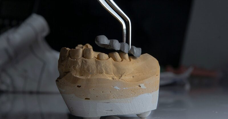 Estructura metálica de una prótesis dental probada con pinzas sobre un modelo de escayola